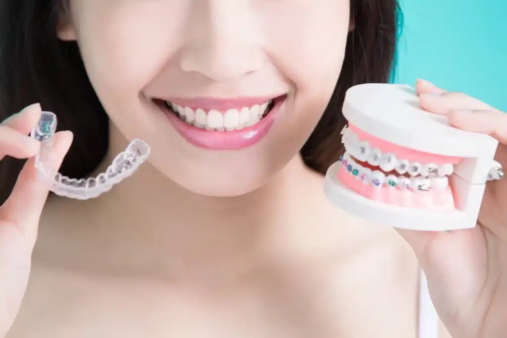 Invisalign Braces Auckland